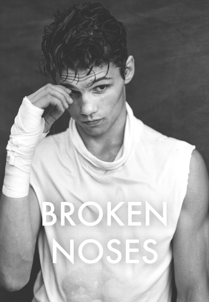 Broken Noses